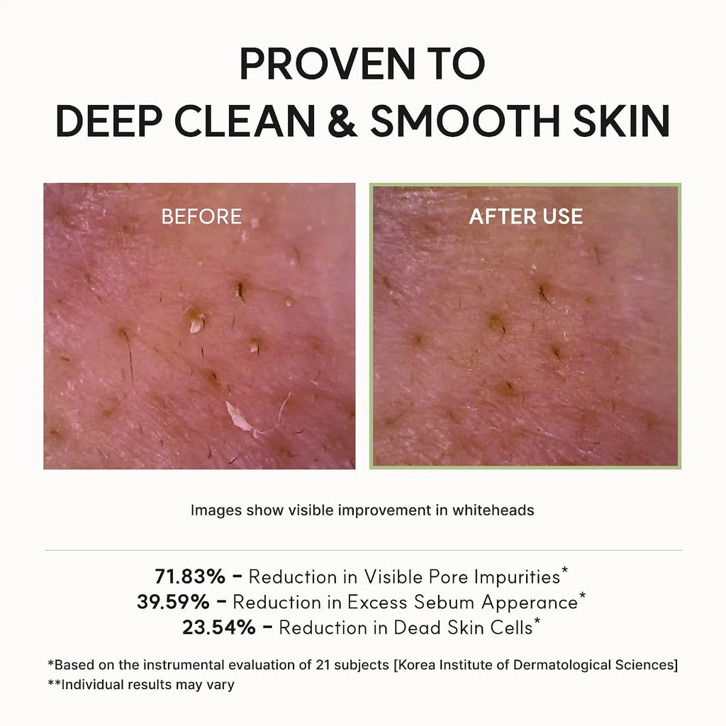 Arencia Fresh Green Rice Mochi Cleanser | Deep Pore Korean Cleanser