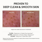 Arencia Fresh Green Rice Mochi Cleanser | Deep Pore Korean Cleanser